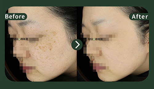 [기미] 20대 전후사진
