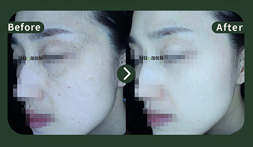 [기미] 40대 전후사진