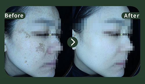 [기미] 40대 전후사진