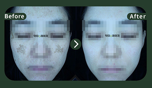 [기미] 40대 전후사진